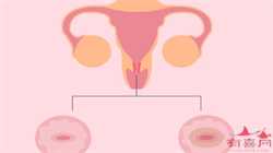 成都代孕专业机构_子宫有囊肿影响代孕吗