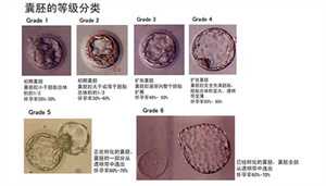成都中国哪里有代孕公司-正规试管代孕中介_宫颈不孕需要什么检查